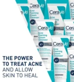 Acne Foaming Cream Cleanser - Image 2