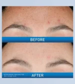 Resurfacing Retinol Serum - Image 6